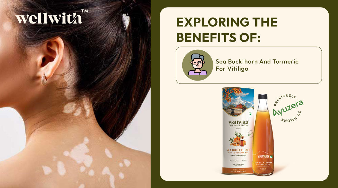 Exploring The Benefits Of Sea Buckthorn And Turmeric For Vitiligo