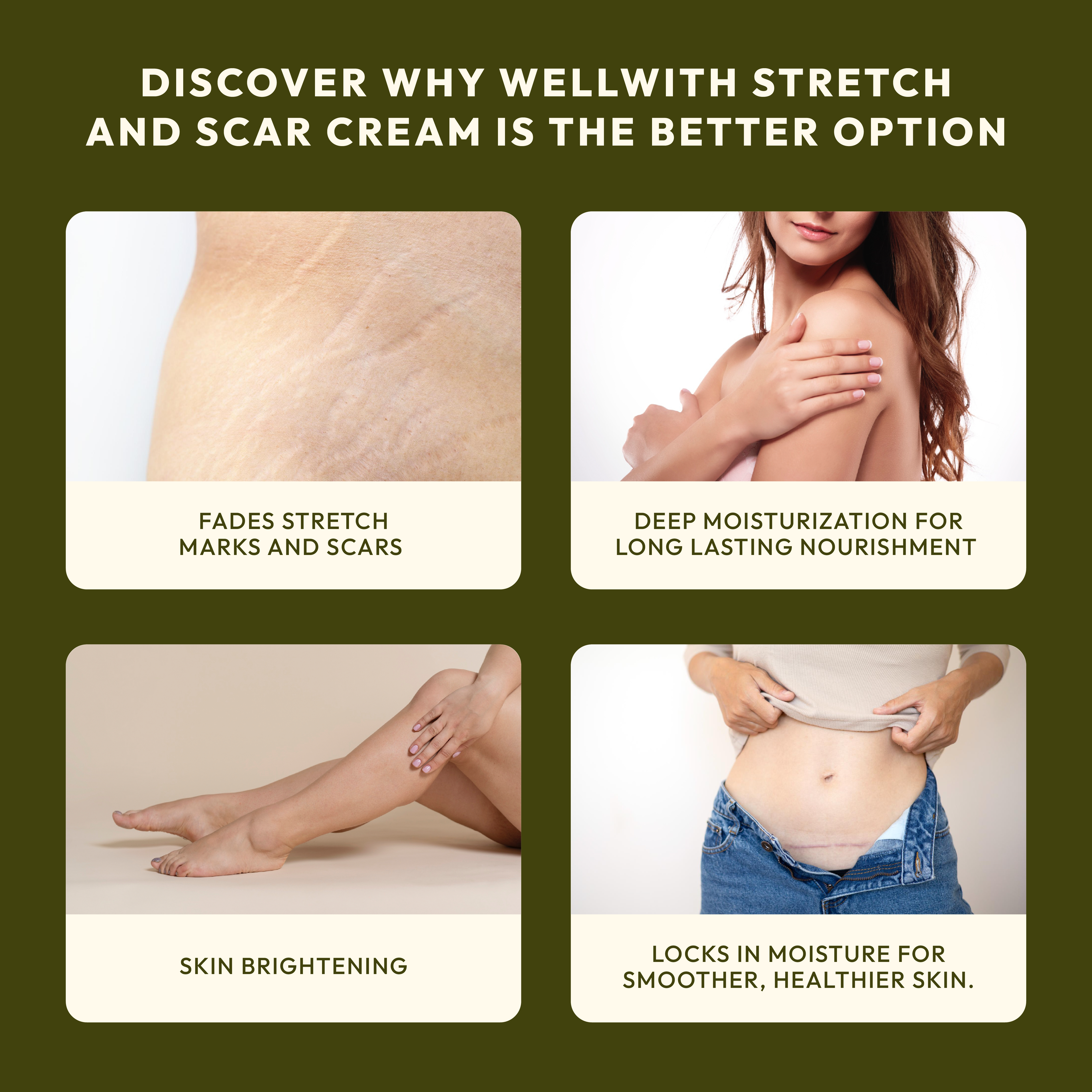 Stretch & Scar Cream 50gm