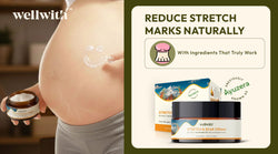 Reduce Stretch Marks Naturally With Ingredients That Truly Work