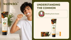 Common Causes of Bleeding Gums and How Herbal Toothpaste Can Help