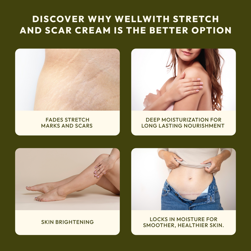 Stretch & Scar Cream 50gm