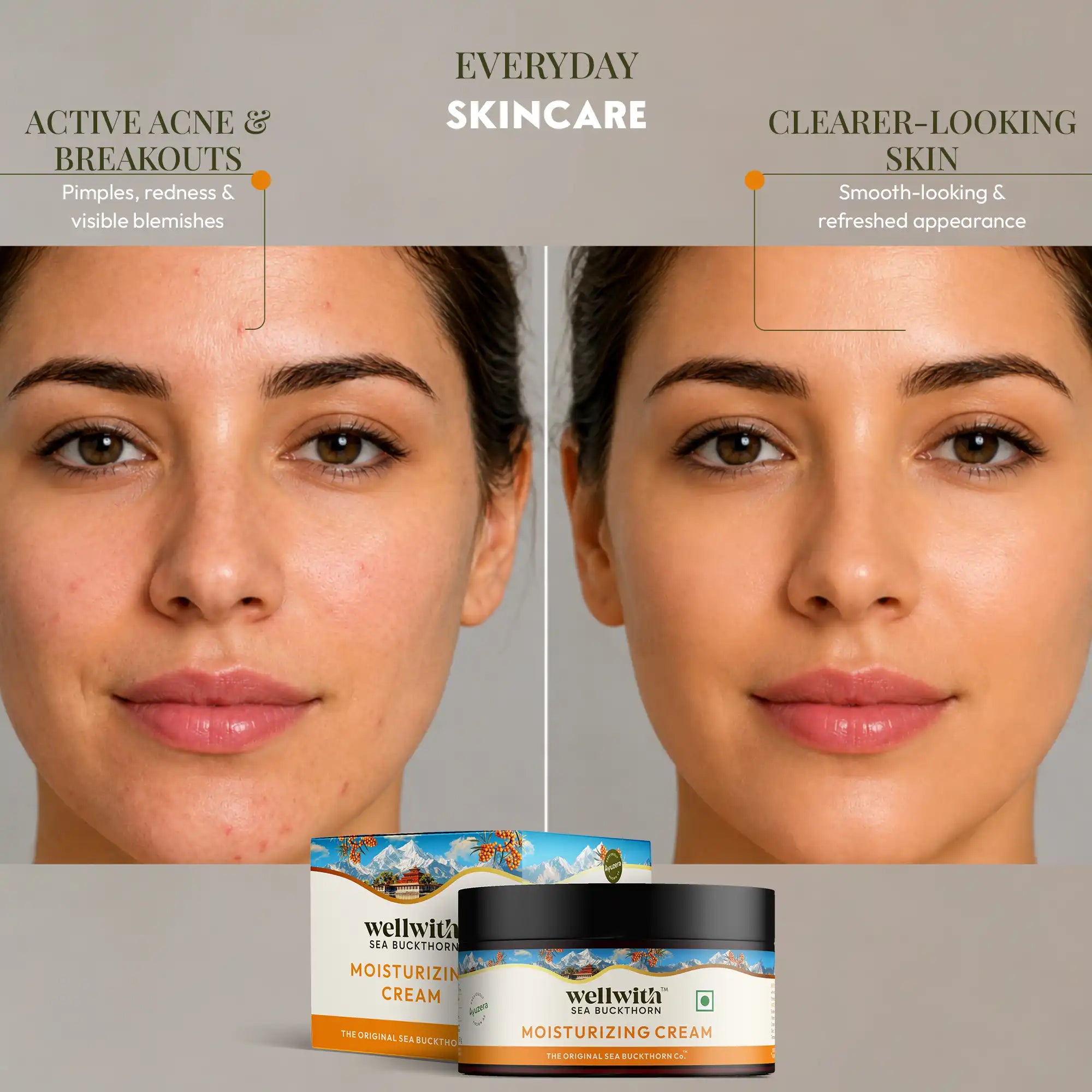 Sea Buckthorn Moisturizing Cream 50gm